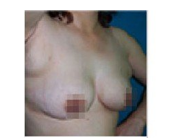 ���������ķ���������Ч��