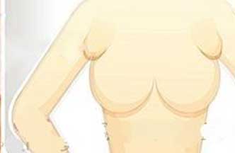 副乳如何形成切除手术的方式 副乳如何形成切除手术的方式