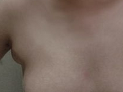 副乳吸脂事项须知