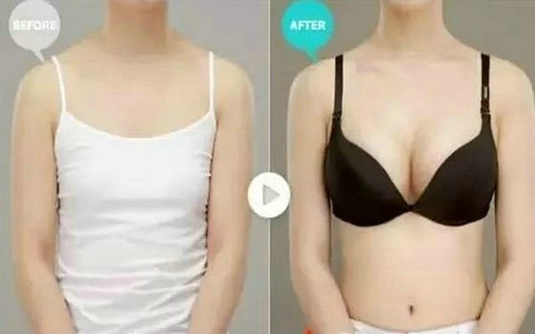解析丰胸手术的方法