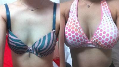 青春活细胞美胸的原理 青春活细胞美胸的原理