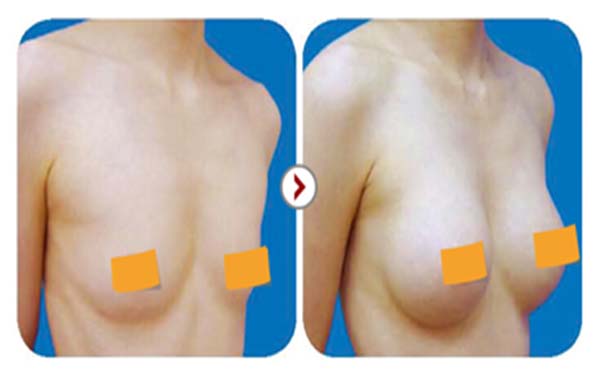 ������ض�ûָ�