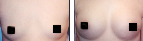 ֬������Ժ��ܱ�����