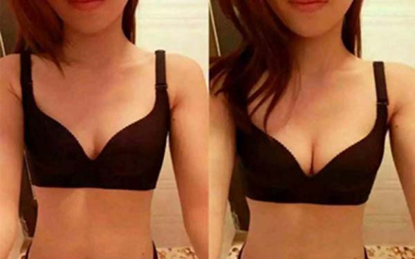 隆胸手术后如何进行胸部保养
