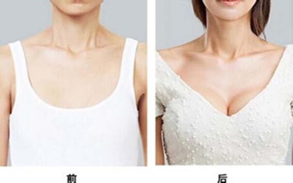 假体隆胸手术的术后护理有哪些方面