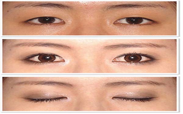 ΢������