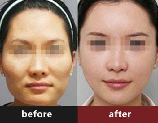 �沿���ע��