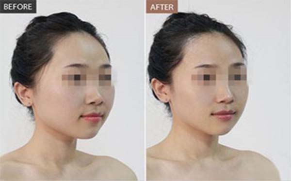 �������ζ���Ǯ