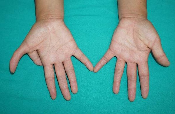 ��ָ������������Ǯ