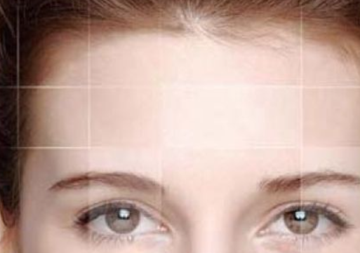 做额头整形术后应该怎样护理? 做额头整形术后应该怎样护理?