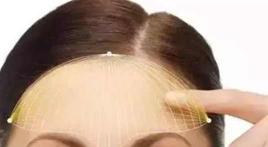 怎么把额头缩小? 怎么把额头缩小?