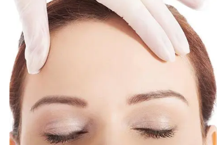 额头缩小术手术原理 额头缩小术手术原理