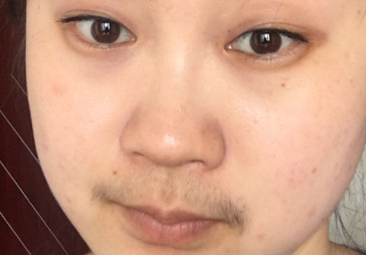 脸颊两边的脸骨突出怎么改善