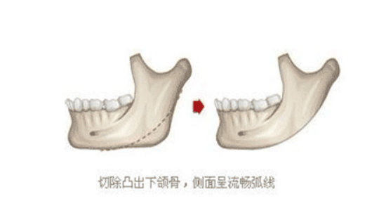 劈外板是什么意思 劈外板是什么意思