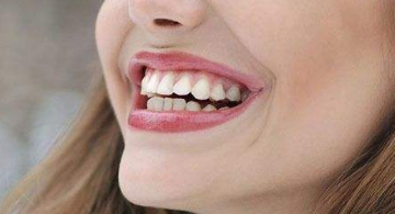 反颌矫正手术多少钱