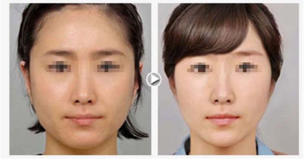 ���ǵ�Σ��