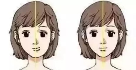 偏颌正颌价格 偏颌正颌价格