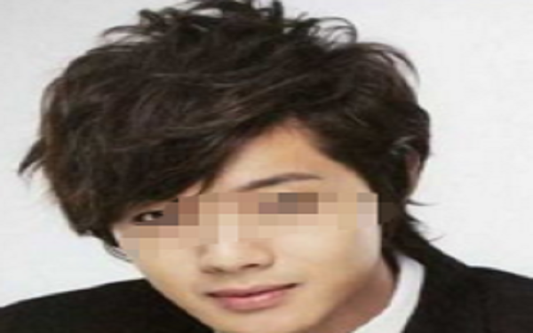 男生下颚骨整形多少钱? 男生下颚骨整形多少钱?