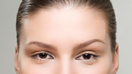 植发际线前后对比图 植发际线前后对比图