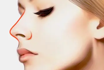 鼻子被打歪了矫正手术多少钱 鼻子被打歪了矫正手术多少钱