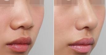 ���ͽ�����ע��������ʲô