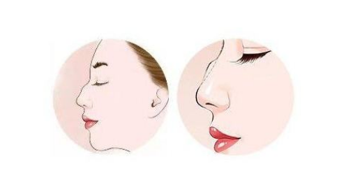 �����ĸ�ҽ�������������շ�ǽ���?