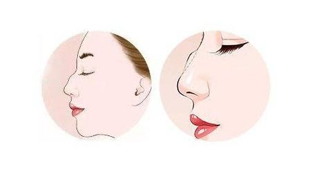 �շ�ǵĽ�������