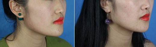 �շ�ǽ����Ա���Ƭ