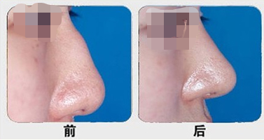 �շ�ǽ���ǰ��Ա�ͼ