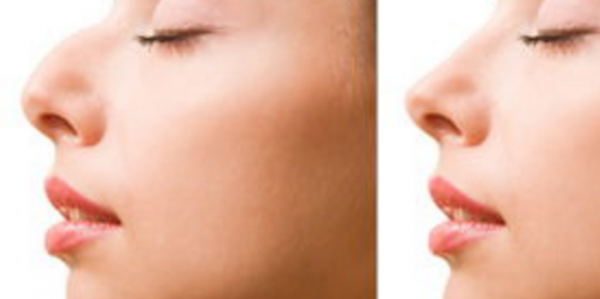 �շ�ǽ���ͼƬ