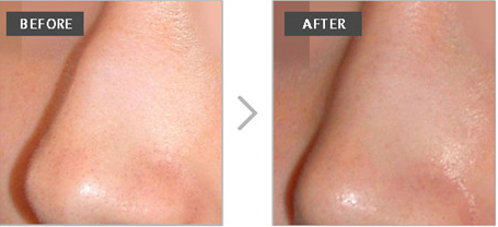 �շ�ǽ����ָ�����ͼƬ