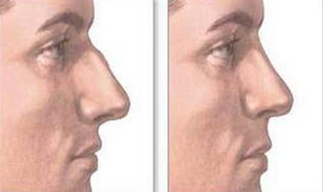 �շ�����ζԱ�Ч��ͼ