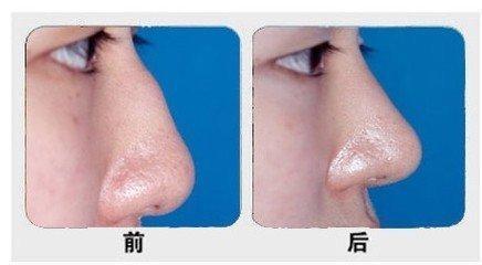 �շ����ֱ��ĥ����