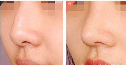 �����շ�ǵķ�������Щ��