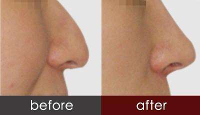 �շ�ǽ���ǰҪע��ʲô��