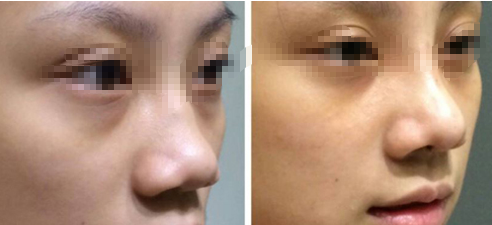 �շ�ǽ����۸��Ƕ��٣� 