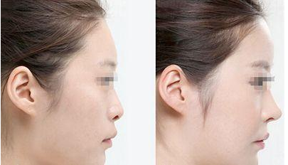 �շ��������ǰע������