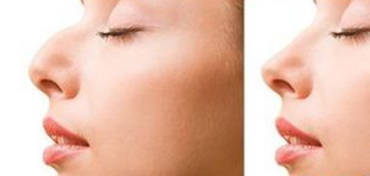 ��������շ�� 