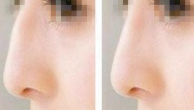 �����շ�ǽ����ļ�ҽԺ��