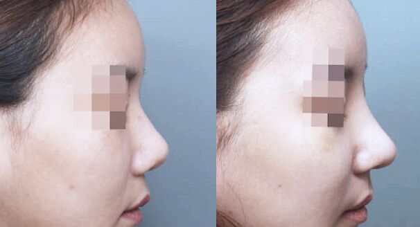 �人�����շ�ǽ������ú�