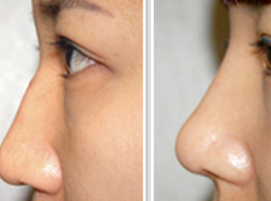 �人���շ�ǽ����õ�ҽԺ���ļ�