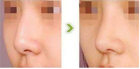 �ൺ���շ�ǽ����к���֢��	