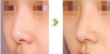 ��Ǻ��շ����õĽ���������ʲô 