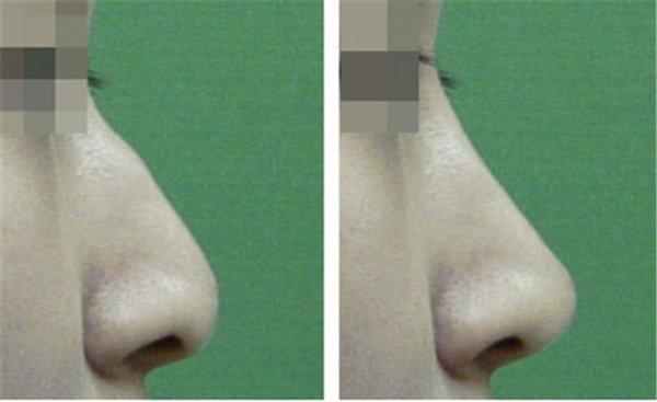 ��ɽ���շ�ǽ����۸��Ƕ���