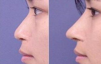 �����շ���ӽ�����������ʽ����Щ�� 