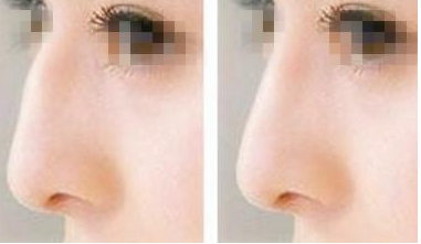 �����շ����ν���Ч���� 