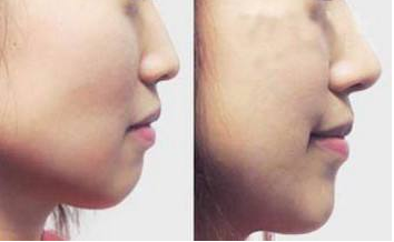 �����շ�ǽ����Ĳ����������� 