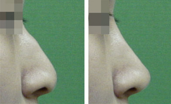 �������س��շ�������ļ�Ǯ��Ҫ����