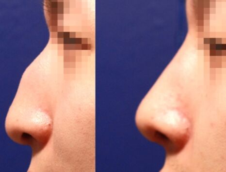 ĥ�շ��ǰ��Ա�