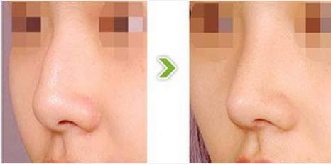 �����շ�ǽ�����������